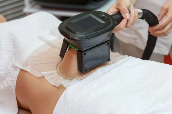Image of person having fat freezing treatment to help weight gain Scotstounhill