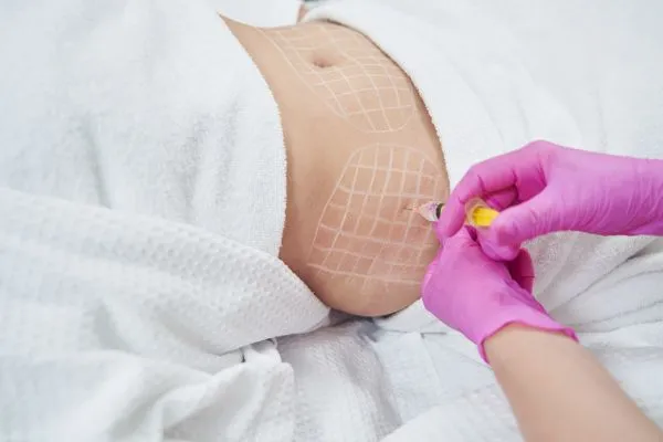 image of fat dissolving injections on love handles to help combat weight gain Scotstounhill